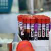 Peste 75 de litri de sânge recoltați în cadrul campaniei de donare ”Avem același sânge”, organizată în Baia Mare